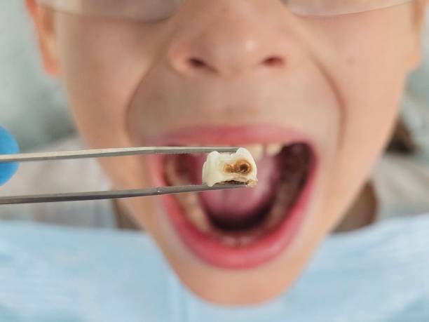 Best After-Hours Dental Trauma Care in Bowling Green, FL